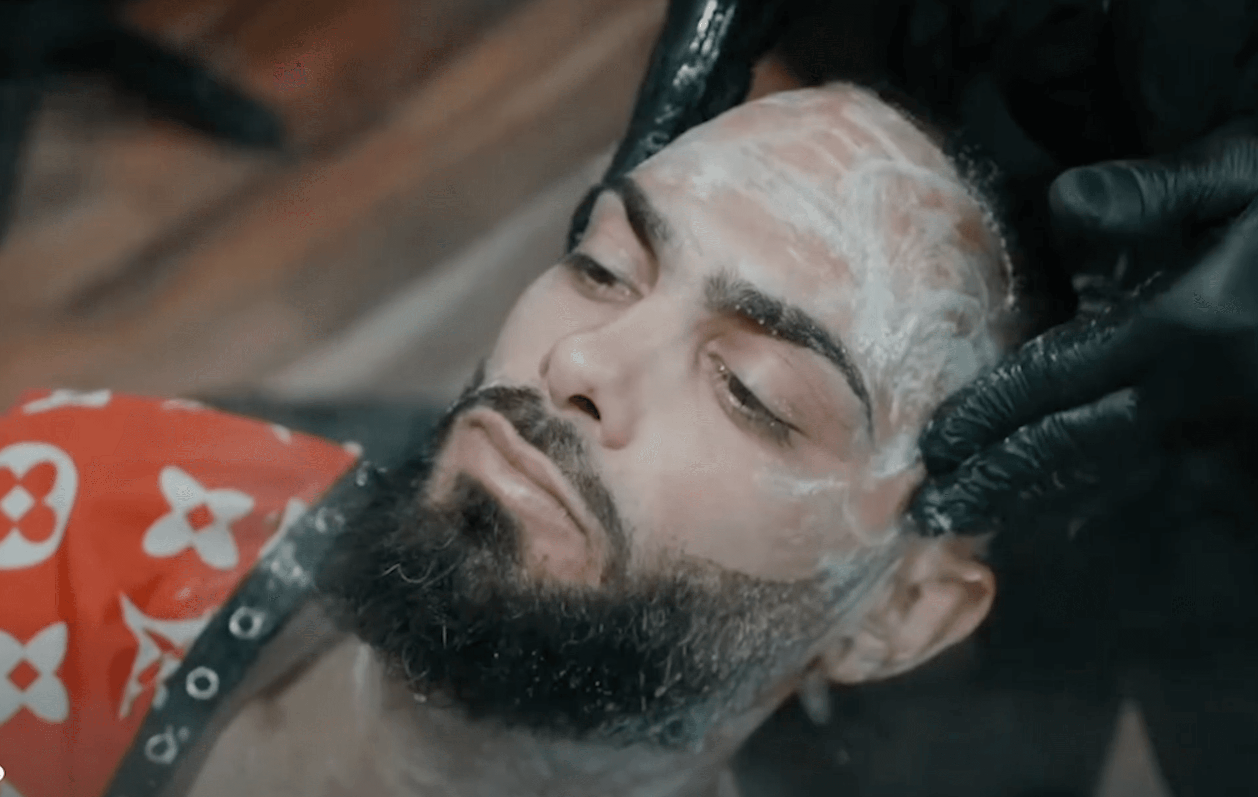 Facial Vitamin C